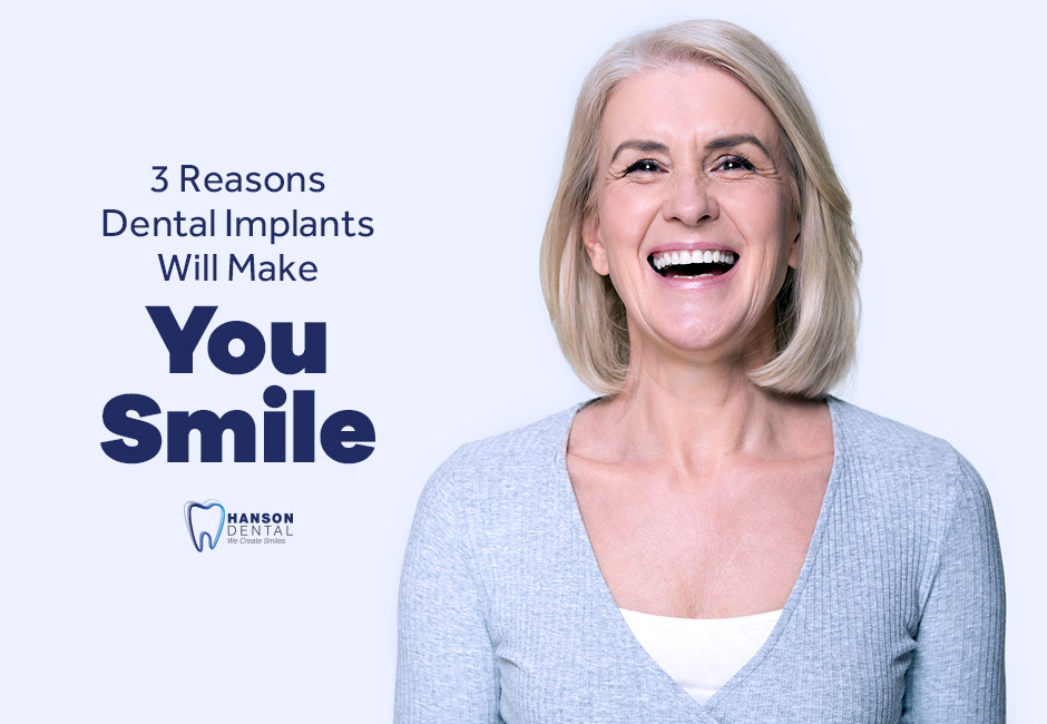 3 Reasons Dental Implants Will Make You Smile