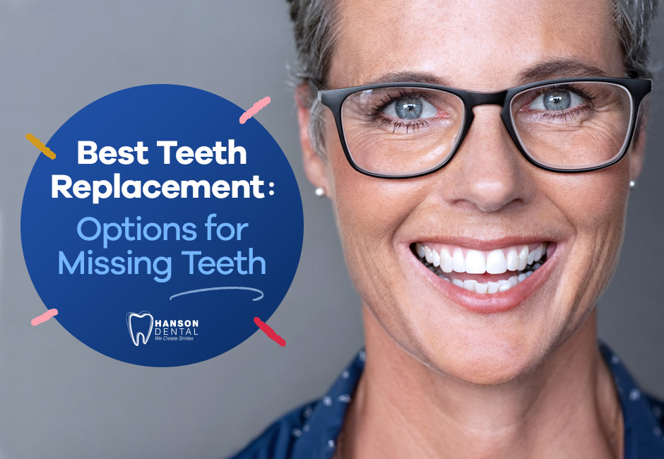 Best Teeth Replacement: Options for Missing Teeth