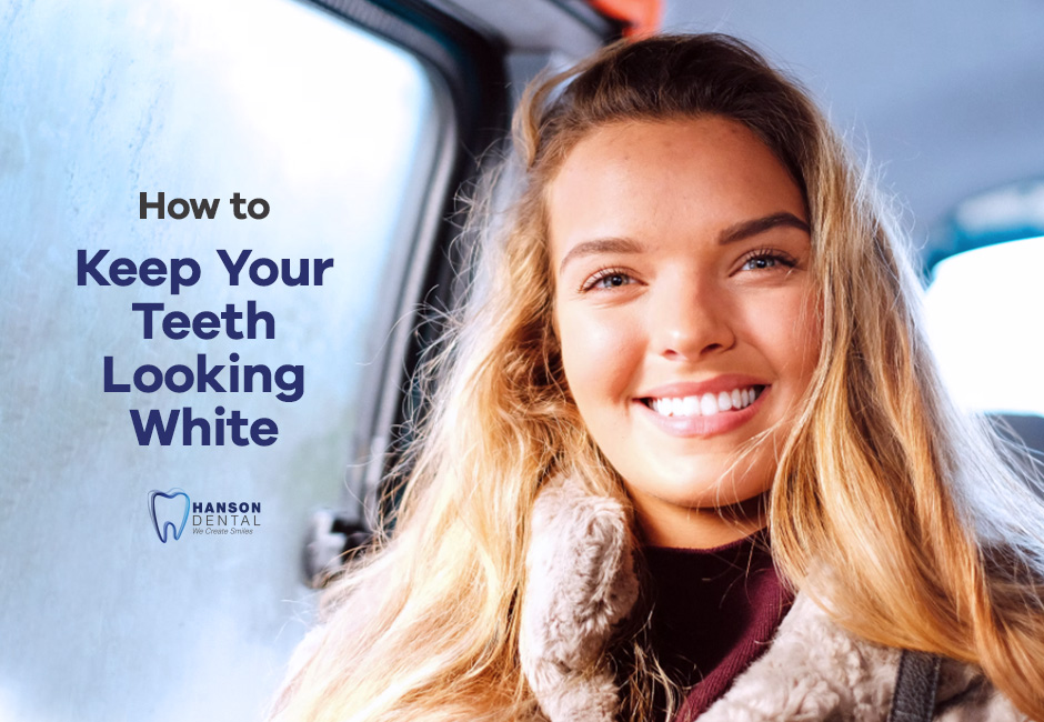 How to Keep Your Teeth Looking White