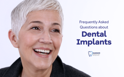 Frequently Asked Questions about Dental Implants