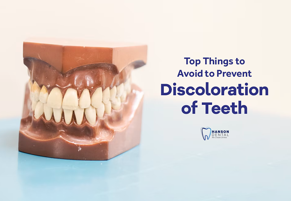 Top Things to Avoid to Prevent Discoloration of Teeth